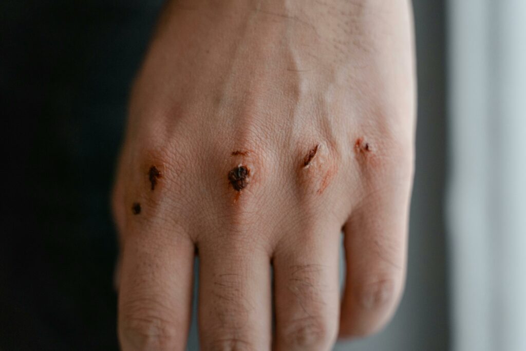 A hand with fake wounded knuckles created using Ben Nye products
